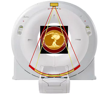 aquilion ct scanner