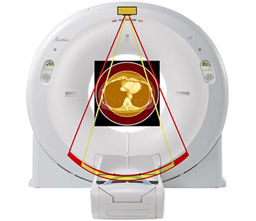 aquilion ct scanner